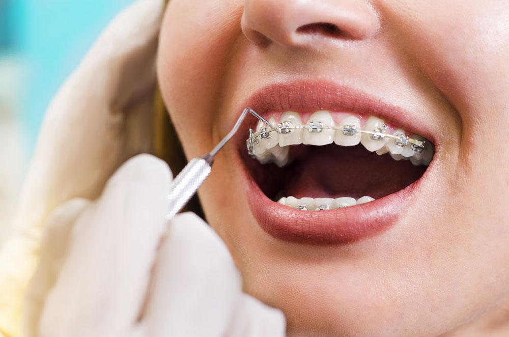 Orthodontie-